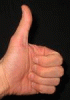 Thumb-1.gif