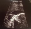 Conner 21 week ultrasound.jpg