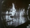 Conner 22 week ultrasound.jpg